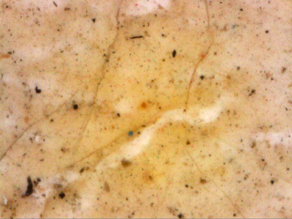 Immagine al microscopio dell’incarnato sulla fronte (235x) (fig. 4)